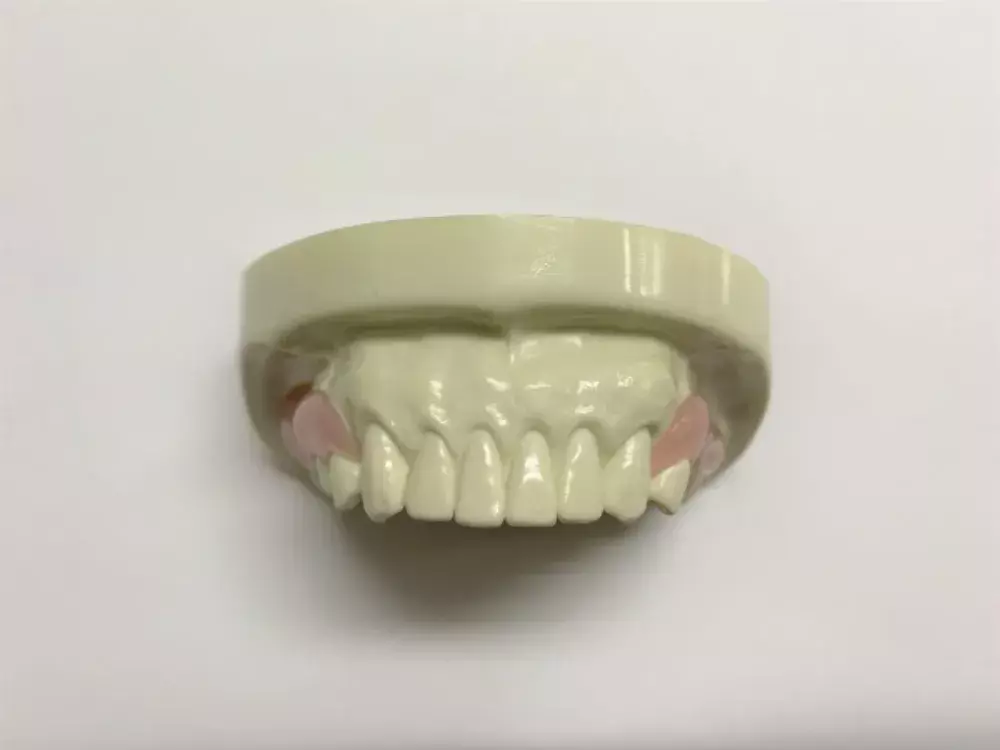 入れ歯